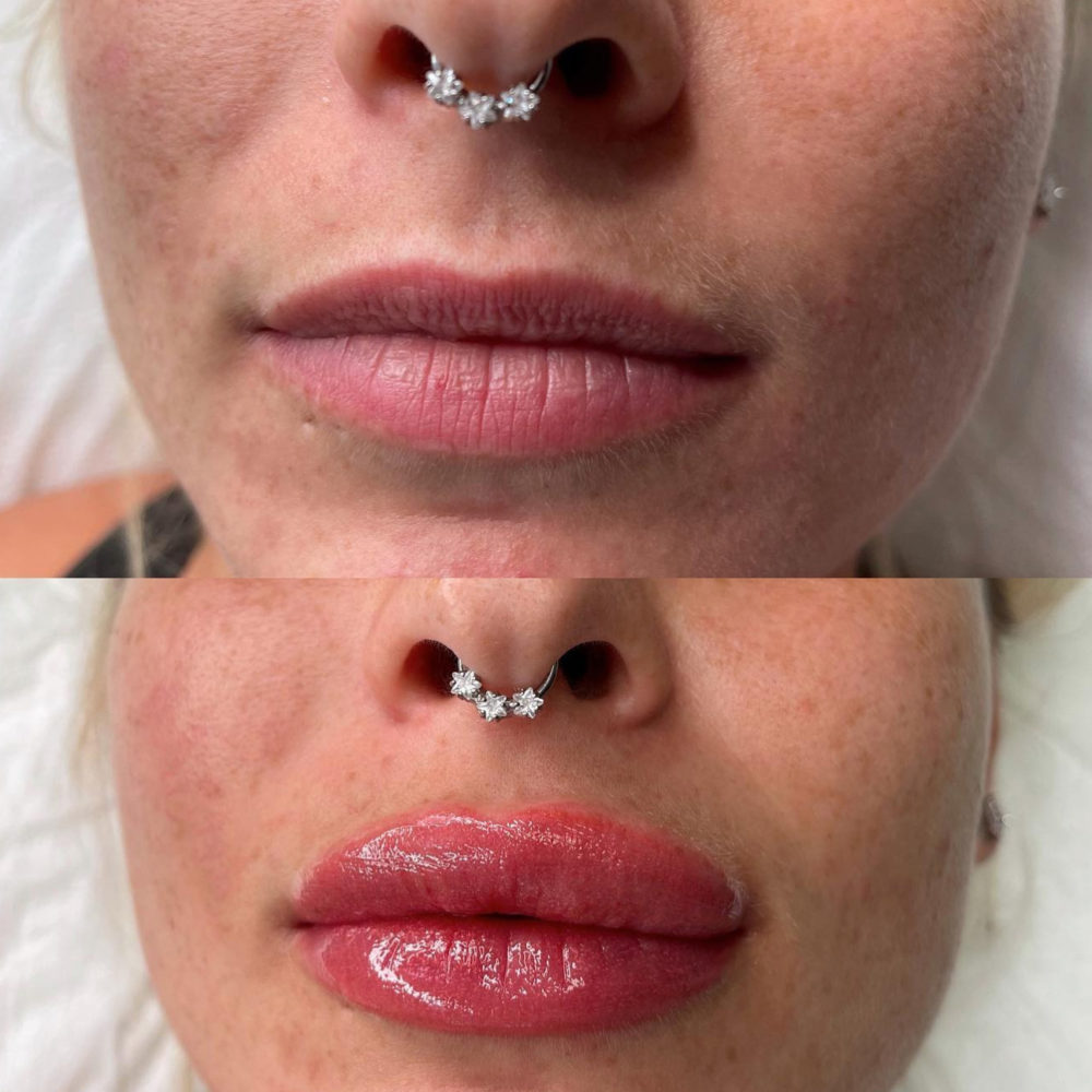 lip-blush-microblading